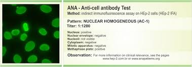 Image result for ANA Staining Pattern