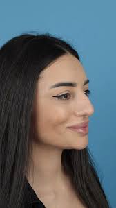 #muhammetdilber #makeup #rhinoplastysociety #rhinoplastyturkey #beauty  #youtubeshorts