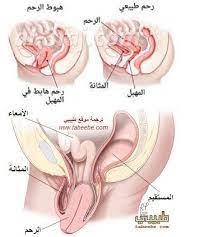 تنشأ قيادة العاهل اعراض هبوط المستقيم عند النساء comertinsaat com