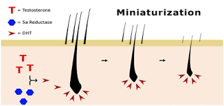 Natural dht blockers are inherently weaker than prescription dht blockers. 12 Most Powerful Natural Dht Blockers That Stop Hair Loss Ak Clinics