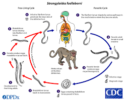 Cdc Dpdx Strongyloidiasis