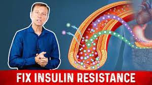 Gip can impact insulin sensitivity. 7 Things That Boost Insulin Sensitivity Or Reverse Insulin Resistance Youtube