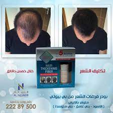تكثيف الشعر خلال ٥ دقايق فقط مع بودر الفراغات من بي بيوتي المتوفر لدى شركة النسائم لمواد وأدوات التجميل hair thickening incoming call screenshot incoming call