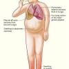 Frequenza respiratoria e sua tipologia. 1