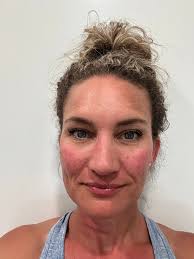 Still trying to figure things out with my husbands RA- no one really tells  you what to expect when you do see dr finally-- so is this normal ----  you'll have kinda