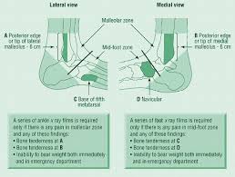 Ottawa Ankle Rules Mdcalc Medical Radiography Medical Business Medical Training