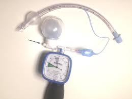 Subscribe to receive the latest news from the international tennis federation via our weekly newsletter. Automatic Regulation Of The Endotracheal Tube Cuff Pressure With A Portable Elastomeric Device A Randomised Controlled Study Sciencedirect