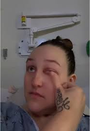 Día 10: Camino hacia la recuperación ❤️‍🩹