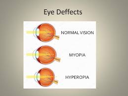 What does it mean when a lens has negative focal length? Convex Lenses Thicker In The Center Than Edges Ppt Download