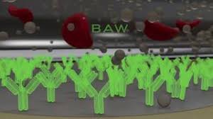 Zom stock to buy | zomedica stock news and prediction. Successful Remote Installation Of Truforma Nyse Zom