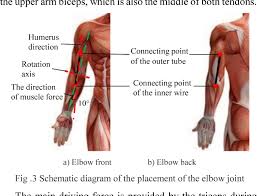 This may cause pain and tenderness when moving the affected upper and lower arm, hand, wrist, finger, or thumb. Figure 3 From A Tendon Driven Upper Limb Rehabilitation Robot Semantic Scholar