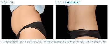 Emsculpt Emsculpt Neo Fettabbau Und Muskelaufbau