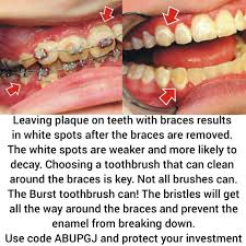 Also, children and individuals with dental braces suffer from this condition. Pin On Needs