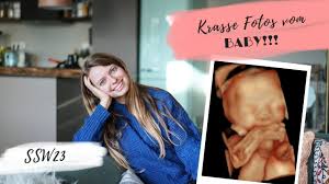 Was passiert bei der feindiagnostik? Feindiagnostik Mein Erfahrungsbericht 23 Ssw Lilies Diary Youtube