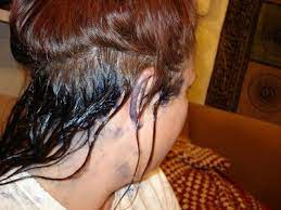Tips For Removing Hair Dye From Skin