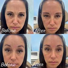 Stop by SKIN FACTOR and meet our newest faces! The Ella Janes! (Yes, they  are both named Ella Jane!)🥰🥰🥰 They would love to talk with you and  answer any questions you have