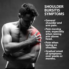 The shoulder bursa acts as a cushion for a tendon in your rotator cuff that connects bone to bone. Bursitis Of The Shoulder Florida Orthopaedic Institute