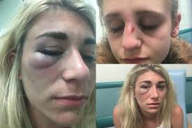 Ashtead teenagers Jade Potter and Georgia McDonnell viciously beaten by  pack of thugs in Sutton High Street