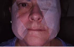 EYES: I've had a condition called nocturnal lagophthalmos since I was a kid  which means that when I sleep, my eyes remain slightly open and the lids do  not fully close. (Kinda