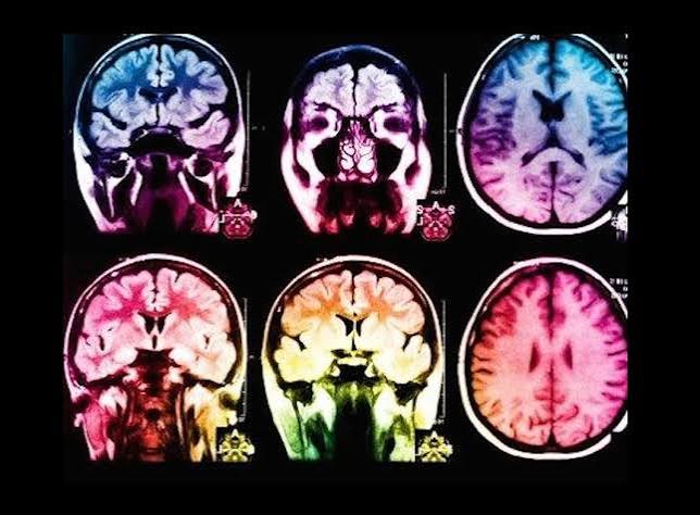 Brain-Dead People Could be 'Brought Back to Life,' Thanks to New Biotech  Experiments