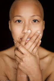 Robert Houser's portraits spotlight cancer patients as they reveal hair  loss and scars