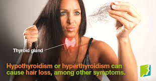 Related causes of hair loss include: Thyroid Problems And Hair Loss Menopause Now