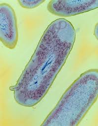 Image result for Shigella