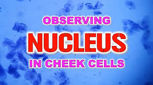Maybe you would like to learn more about one of these? Observing Nucleus In Cheek Cells Youtube
