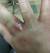 Hair Splinter In Eye
