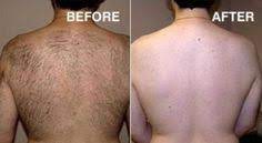 Does nono stop hair growing back ? No No Hair Removal System Reviews