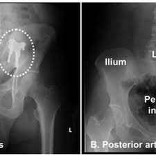 Gerhard ludwig müller kgchs (pronounced ˈɡeːɐ̯haʁt ˈluːtvɪç ˈmʏlɐ; Magdalena Muller Gerbl University Of Basel Basel Unibas Institute Of Anatomy