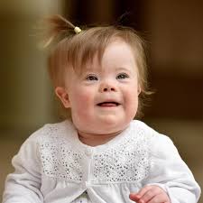 People see Down's Syndrome as a disability but we feel lucky to have a  child like Bella