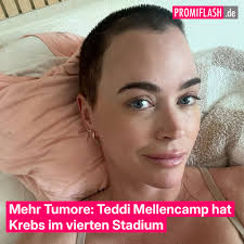 https://www.promiflash.de/news/2025/04/03/mehr-tumore-teddi-mellencamp-hat-krebs-im-vierten-stadium.html  Schockdiagnose: Wie kämpft "Real Housewives"-Star Teddi Mellencamp gegen  vier neue Tumore an? Familie und Freunde geben Rückhalt.