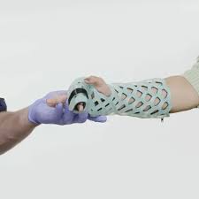 Image result for Radial Gutter Cast