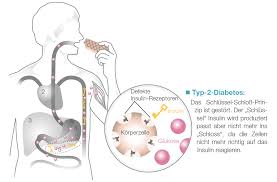 Welche Diabetes Typen Gibt Es