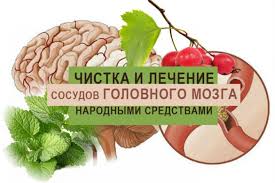 Lechenie Sosudov Golovnogo Mozga Narodnymi Metodami Golovy I Shei Sredstvami V Domashnih Usloviyah Veny Na Nogah Nizhnih Konechnostej