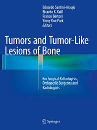 Tumors And Tumor Like Lesions Of Bone Benign Tumor Pathology