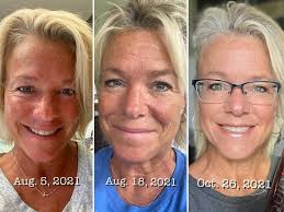 🏆 COUPLE WINS 🏆 My lovely friend Louise & her hubby Lloyd decided to  switch things up… and WOW just take a look 👀 ⚡️ Lloyd dropped nearly a  stone in 15