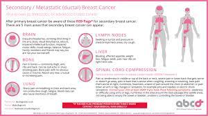 Breast cancer now's survey of 2,100 people in the uk with secondary breast cancer found that just 13% were told of the symptoms to look out for if their cancer spread. Secondary Breast Cancer