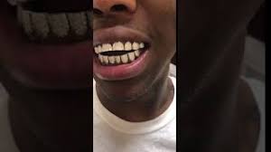 I was looking to get a couple teeth replaced in solid 14k gold where would be the best place to go? Peoria Gold Teeth And More Youtube