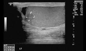 Pin On Radio Genitourinary