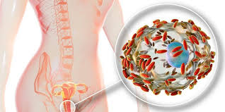 Pelindung tubuh dari infeksi b. Vaginosis Bakteri Bacterial Vaginosis Penyebab Dan Pencegahannya
