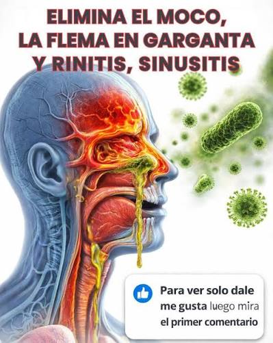 Congestión nasal, probá estos remedios caseros! 🤧🍂 Con la llegada del  otoño, el cambio de temperatura y el aire seco pueden jugar en contra de  nuestras vías respiratorias. Si sentís la nariz