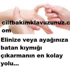 Ele Ayaga Batan Kiymik En Kolay Nasil Cikarilir Holding Hands Thumbs Up Quotes