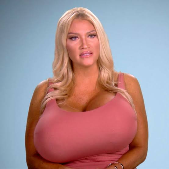 Botched Patient Wants Her Massive Breasts Evened Out