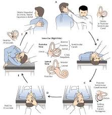 How To Sleep With Vertigo The Root Cause And 7 Helpful Tips Terry Cralle Vertigo Vertigo Treatment Medical Help