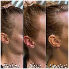 It's pony tail season, let me fluff up that hairline tutz~