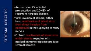 Other findings include irritation, eye redness, watery or purulent secretion, and impaired. Viral Keratitis Diagnosis Management And Latest Guidelines
