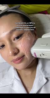 Hifu Before and After Kl