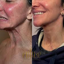 Enfuse Medical Spa™ (@enfusemedicalspa) · Instagram 照片和视频